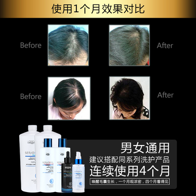 科技賦能防脫，歐萊雅芯基源洗護(hù)套裝 深入發(fā)芯，重塑強(qiáng)韌發(fā)絲