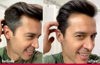 年紀(jì)輕輕就長白頭發(fā)？從沐浴用品到生活方式的全方位應(yīng)對指南